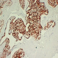 Anti-Cytokeratin 7 Antibody