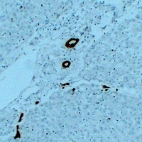 Cytokeratin 7 antibody