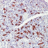 Anti-Cytokeratin 7 Antibody