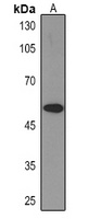 Cytokeratin 8 Mouse Monoclonal Antibody