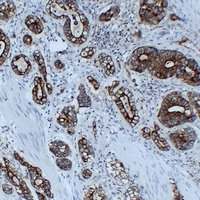 Cytokeratin 8 antibody