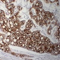 Anti-Cytokeratin 8 Antibody