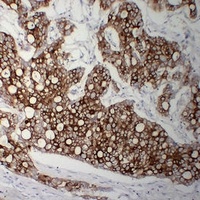 Cytokeratin 8 antibody