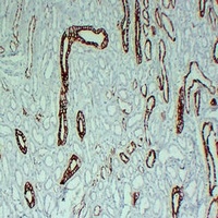 Anti-Cytokeratin 8 Antibody