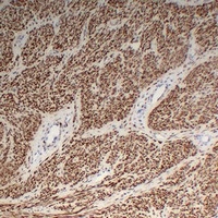 Anti-Desmin Antibody