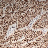 Desmin antibody