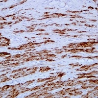 Anti-Desmin Antibody