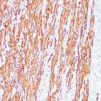 Anti-Desmin Antibody