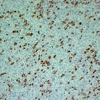 Anti-Fascin Antibody