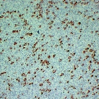 Fascin antibody