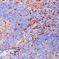 Anti-Fascin Antibody