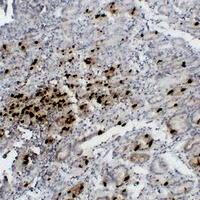 Gastrin Mouse Monoclonal Antibody