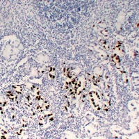 Gastrin Mouse Monoclonal Antibody