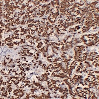 GH1 Antibody