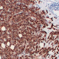 HER2 Mouse Monoclonal Antibody