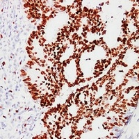 Anti-Ki67 Antibody