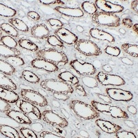 Anti-KSP Cadherin Antibody