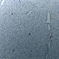 TPSAB1 antibody