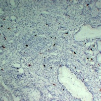 Anti-TPSAB1 Antibody