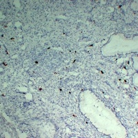 TPSAB1 antibody