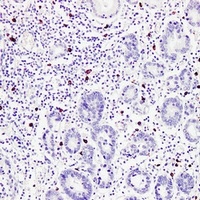 Anti-TPSAB1 Antibody