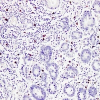 TPSAB1 antibody