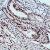 Anti-MSH6 Antibody