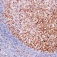 Anti-MSH6 Antibody