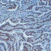 MSH6 Antibody
