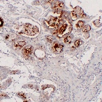 MUC6 Mouse Monoclonal Antibody