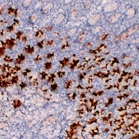 MUC6 Mouse Monoclonal Antibody