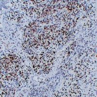 MYOG Mouse Monoclonal Antibody