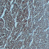 Anti-NEFL Antibody