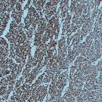 NEFL antibody