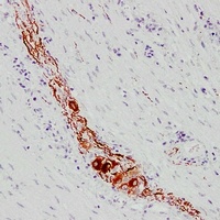 Anti-NEFL Antibody