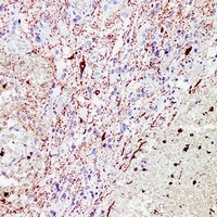 Anti-NEFL Antibody