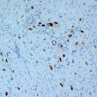 p57 Kip2 Antibody