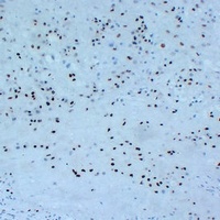 p57 Kip2 Antibody
