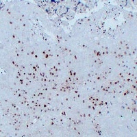 p57 Kip2 Antibody