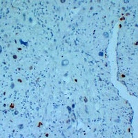 p57 Kip2 Antibody