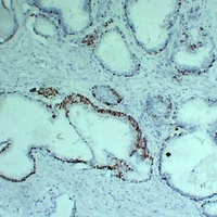 p63 Mouse Monoclonal Antibody