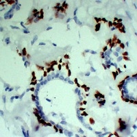 p63 Mouse Monoclonal Antibody