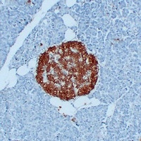 Anti-PGP9.5 Antibody