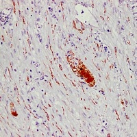 Anti-PGP9.5 Antibody