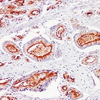 Kallikrein 3 Mouse Monoclonal Antibody