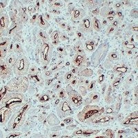 Anti-PSMA Antibody