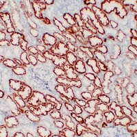 Von Hippel Lindau Mouse Monoclonal Antibody