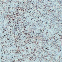 Anti-S100-A4 Antibody