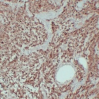 Anti-S100-A1 Antibody