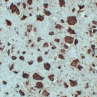 ACP5 Mouse Monoclonal Antibody